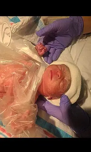 Childbirth baby Miracle